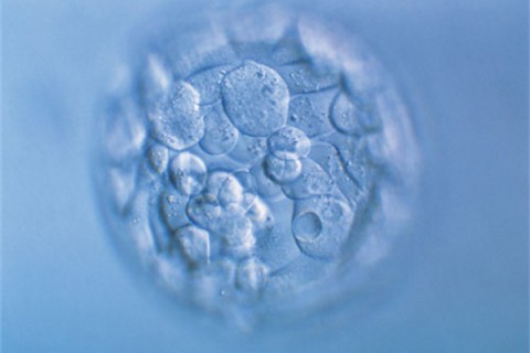 http://foshan.quanwangkm.com/post/190.html|佛山人工试管